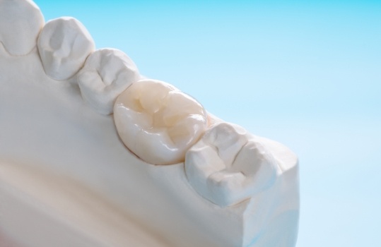 diagram of dental crown