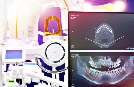 Tools holding tooth after tooth extraction in Roselle Park for dental implants 