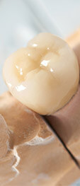 single tooth prosthetic