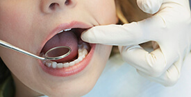 dentist preforming oral cancer screening