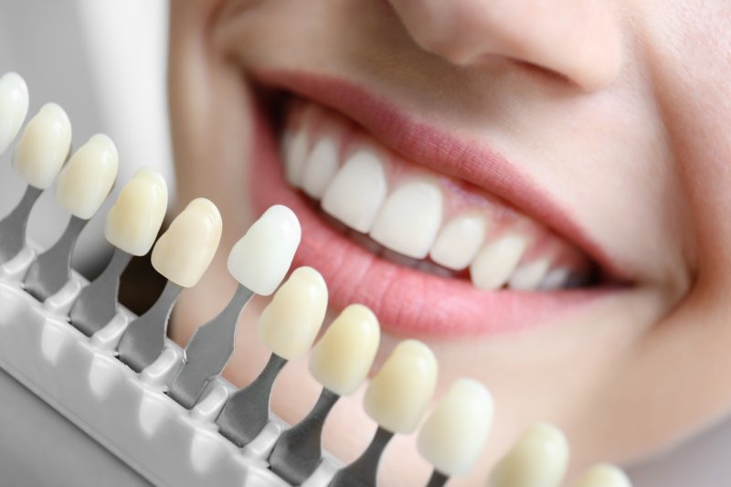 a person smiling while a dentist holds a shade guide to determine the color of their new teeth