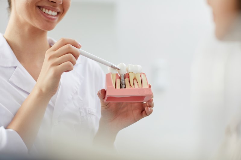 Dentist smiling and holding a model of an implant