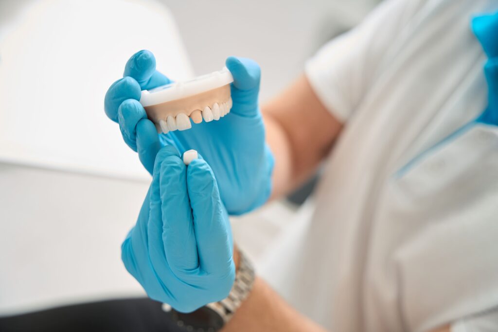 Dentist in blue gloves placing sample crown over model abutment tooth